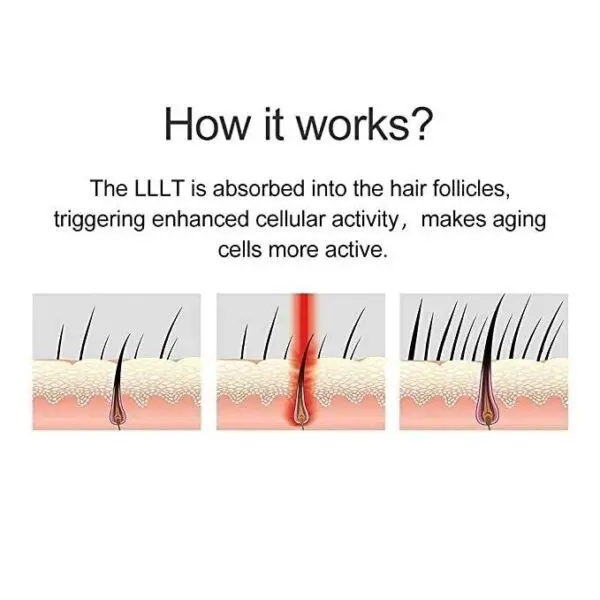 LESCOLTON Hair Growth System - Image 4